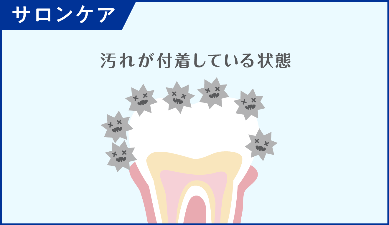 サロンケアのイメージ